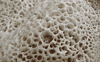 injera